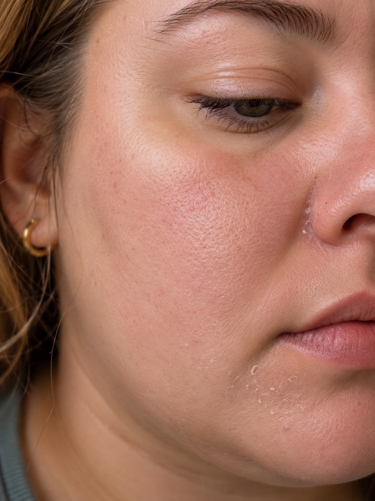 Close-up of facial skin showing texture and pores